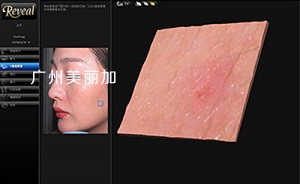 皮肤检测,皮肤有哪些问题,专业的皮肤测试,广州美丽加,reveal皮肤检测仪,国内仪器厂家,操作界面