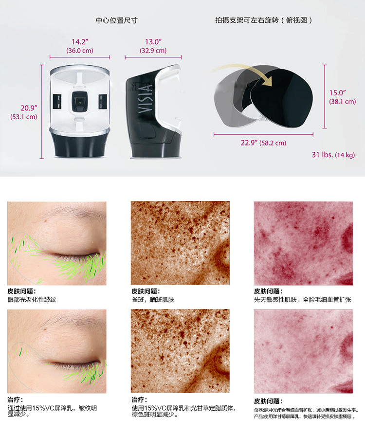 visia7皮肤检测仪,皮肤管理,皮秒必备仪器