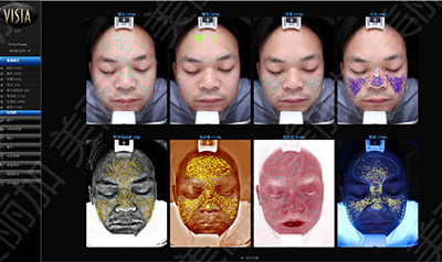 广州美丽加,visia皮肤检测仪尺寸大小 ,面部分析,皮肤检测测试仪,多光成像VISIA操作界面