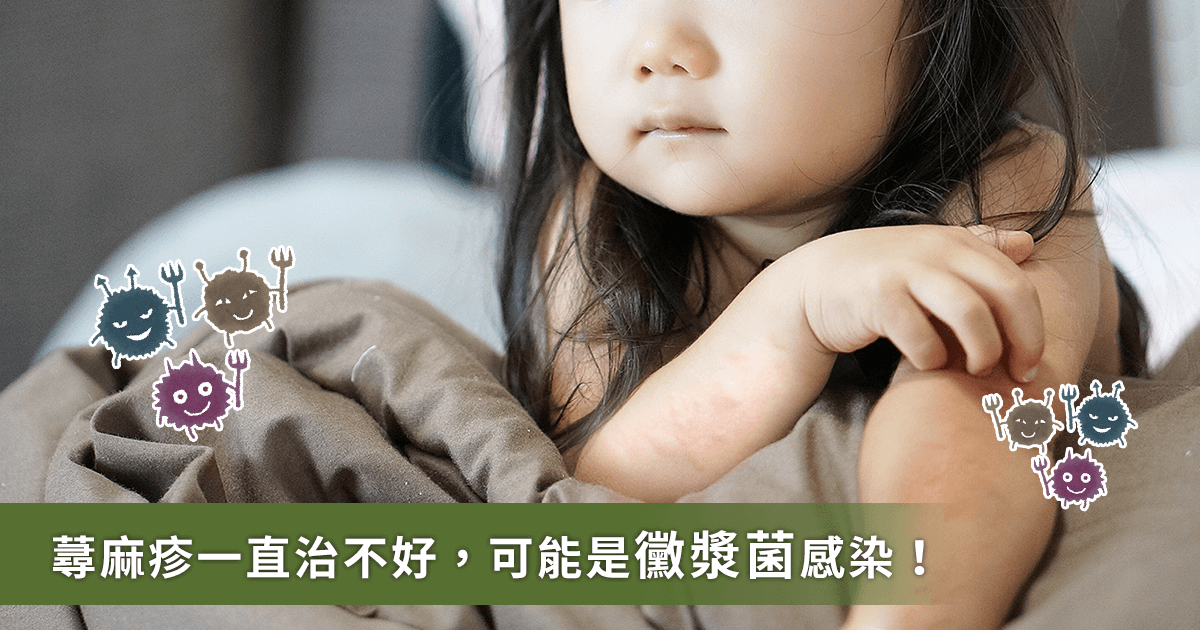 小孩子荨麻疹