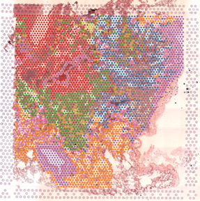 Cloud Zoom small image