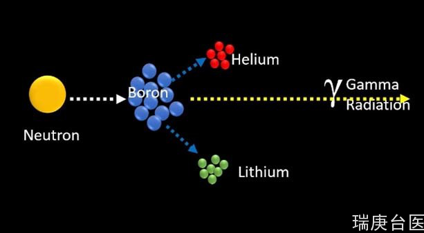 BNCT | 硼中子捕捉疗法治疗脊髓肿瘤