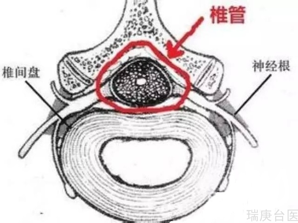 BNCT | 硼中子俘获疗法脊髓肿瘤放疗新选择