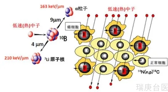 BNCT治疗黑色素瘤案例 | 治疗90天后检查未见明显异常