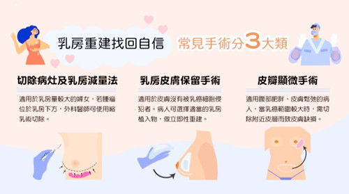 乳癌患者忧成少奶奶 乳房重建找回自信常见手术分3类